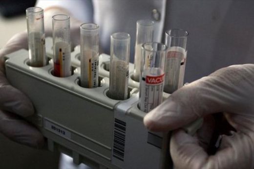 Hepatit B Evlilik Aşısı ve Takibi