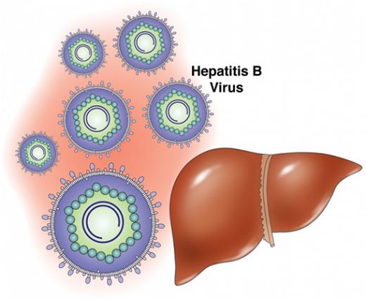 Hepatit B Karaciğer