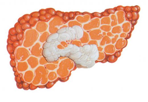 Hepatit B Kronik Belirtileri ve Tedavisi