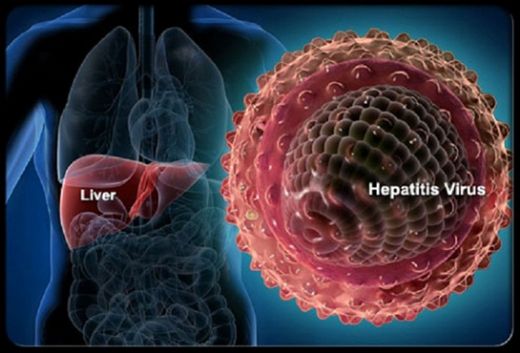 Hepatit Virüsü Çeşitleri