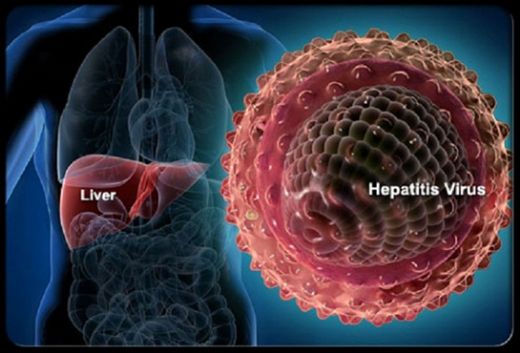 Hepatit Virüsü
